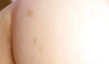 Pervertito medico Fetish Gay, asiatica Senza femmine mature nude preservativo orgia